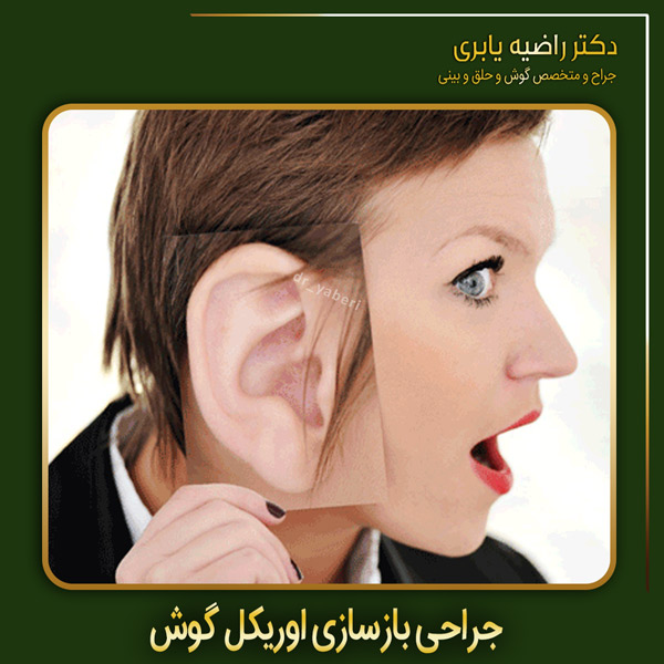 جراحی بازسازی اوریکل گوش - دکتر یابری