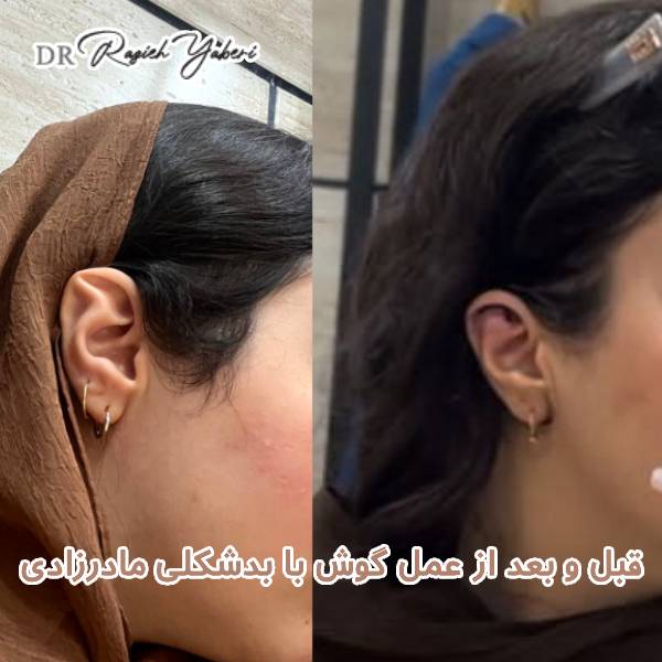 عکس نمونه کار جراحی گوش