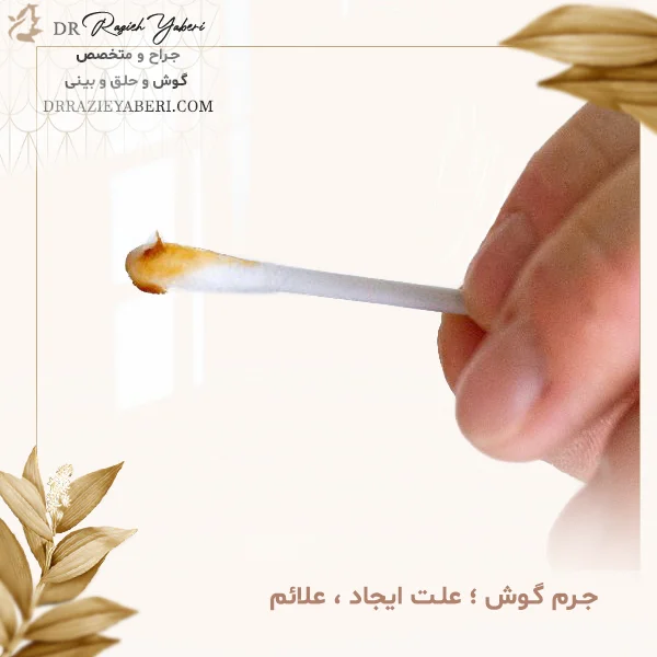 جرم گوش ؛ علت ایجاد ، علائم و روش های خارج کردن آن - دکتر یابری