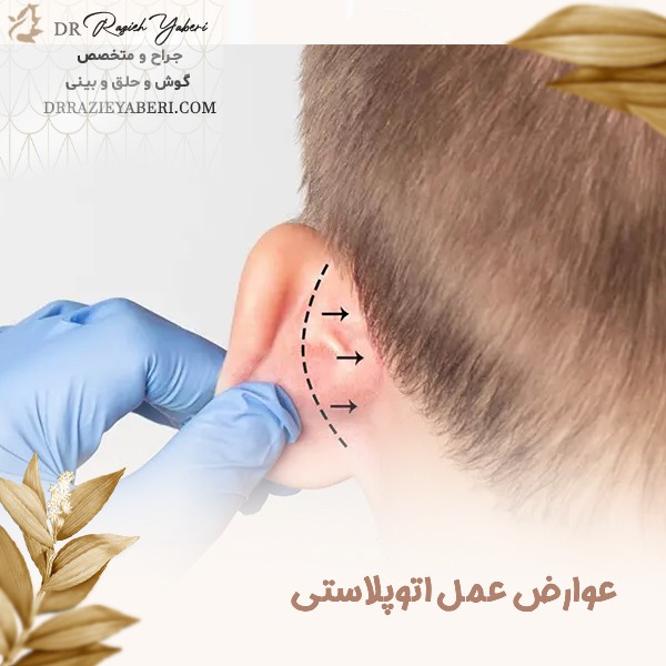 عوارض عمل اتوپلاستی