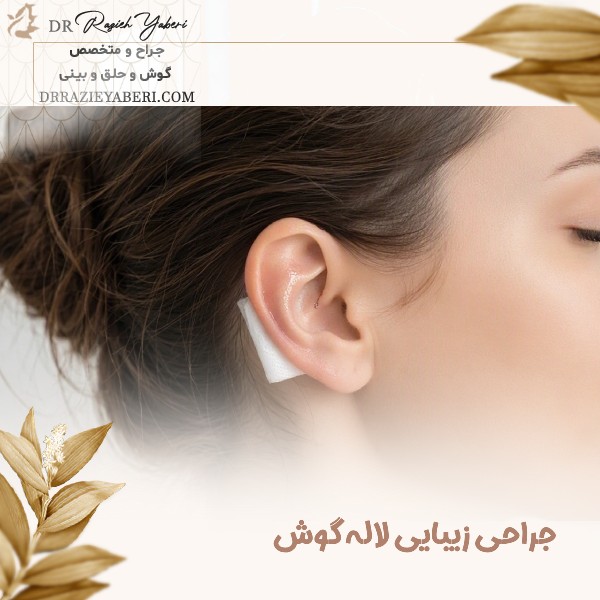 جراحی زیبایی لاله گوش
