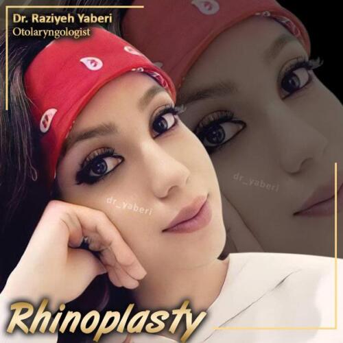 جراحی-بینی-65