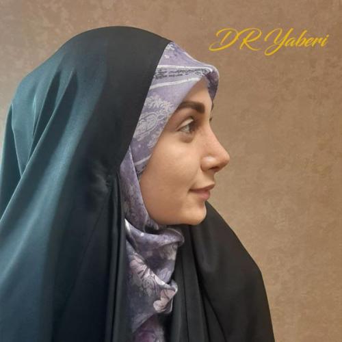 جراحی-بینی-در-تهران103