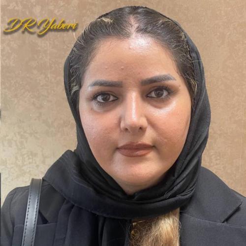 جراحی-بینی-در-تهران106