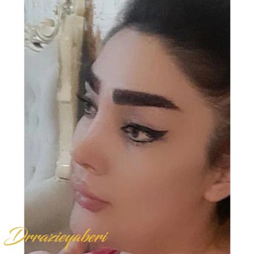 جراحی-بینی-در-تهران123