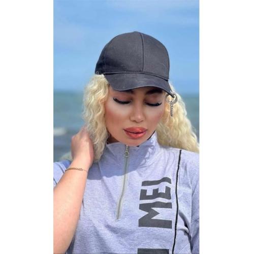 جراحی-بینی-در-تهران93