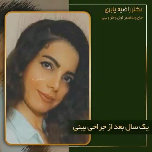 جراحی-زیبایی-بینی-12