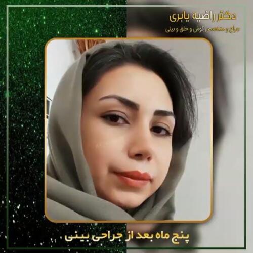 جراحی-زیبایی-بینی-14