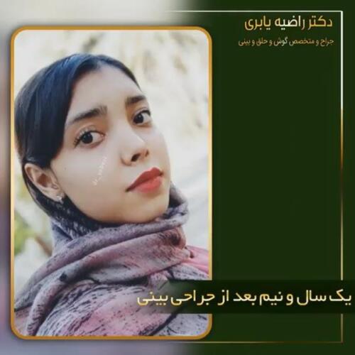 جراحی-زیبایی-بینی-17