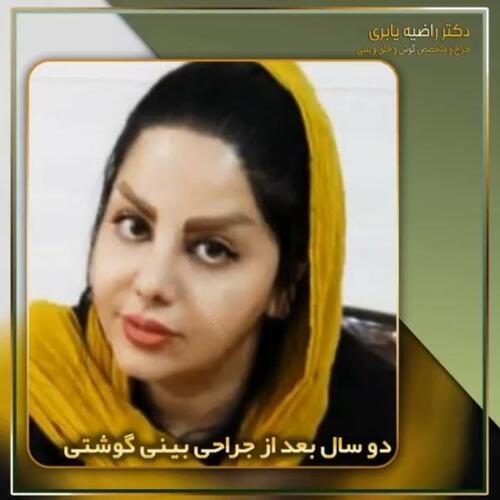 جراحی-زیبایی-بینی-19