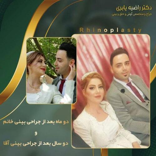 جراحی-زیبایی-بینی-25
