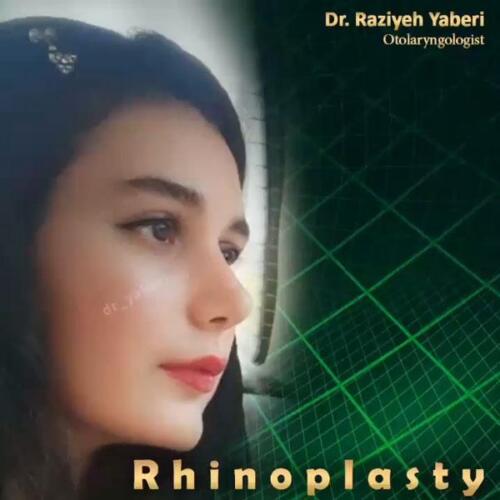 جراحی-زیبایی-بینی-27