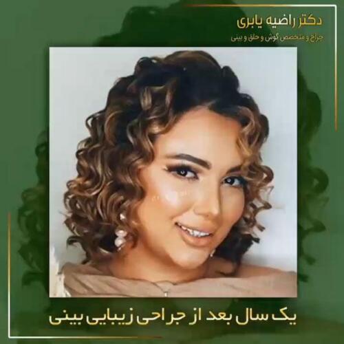 جراحی-زیبایی-بینی-31