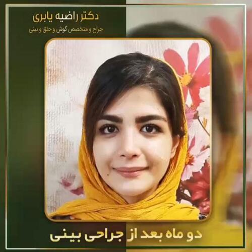 جراحی-زیبایی-بینی-34