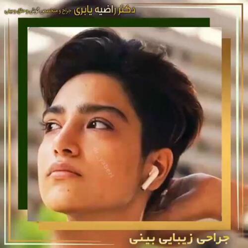 جراحی-زیبایی-بینی-35