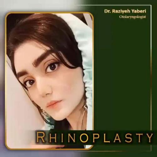 جراحی-زیبایی-بینی-36