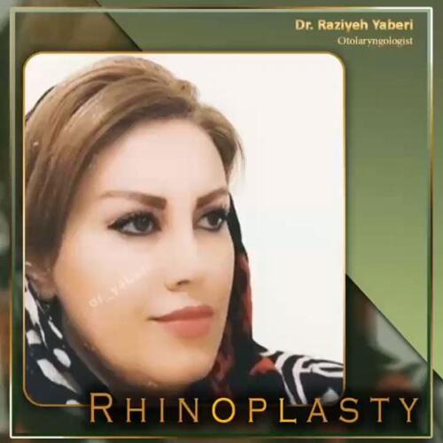 جراحی-زیبایی-بینی-37