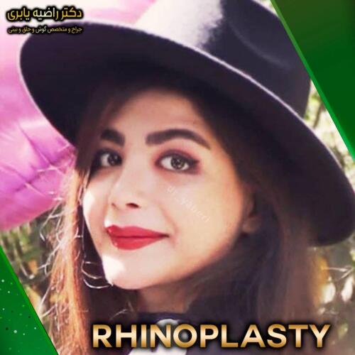 جراحی-زیبایی-بینی-42