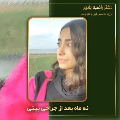 جراحی-زیبایی-بینی-5