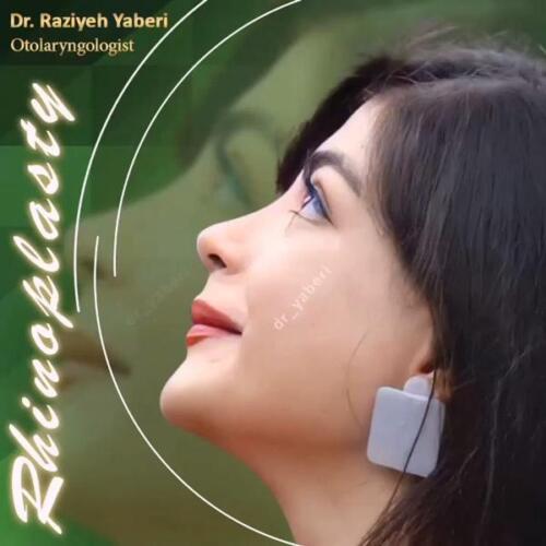 جراحی-زیبایی-بینی-50