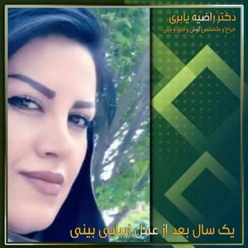 جراحی-زیبایی-بینی-6-1