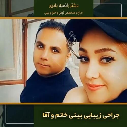 جراحی-زیبایی-بینی-7