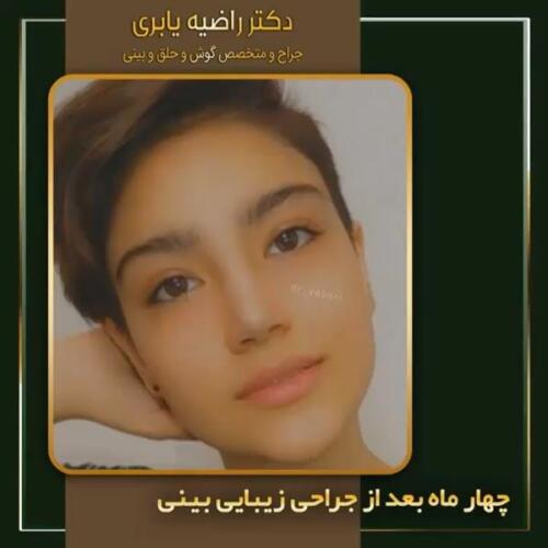 جراحی-زیبایی-بینی-8