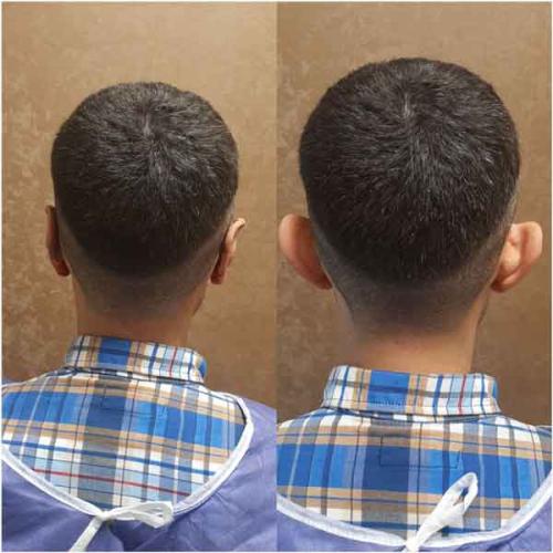 جراحی-گوش-در-تهران-65