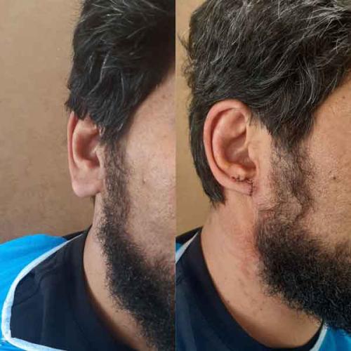 جراحی-گوش-در-تهران-66