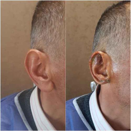 جراحی-گوش-در-تهران-67