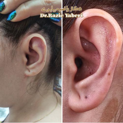 جراحی-گوش-د-رتهران-70