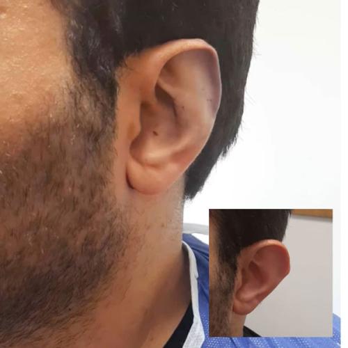 جراحی-گوش-در-تهران-13