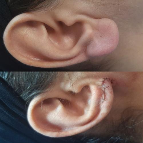 جراحی-گوش-در-تهران-35