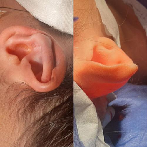 جراحی-گوش-در-تهران-37