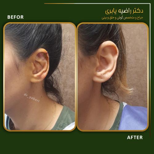 جراحی-گوش-در-تهران-40