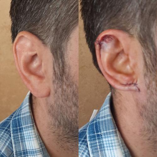 جراحی-گوش-در-تهران-41
