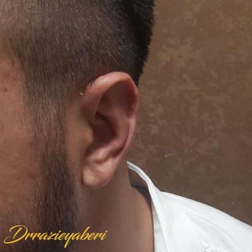 جراحی-گوش-در-تهران-46