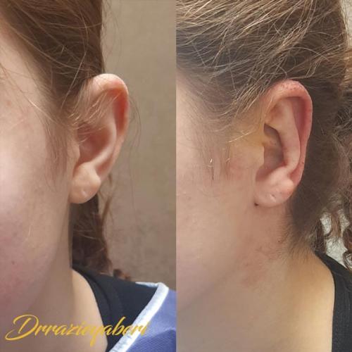 جراحی-گوش-در-تهران-47