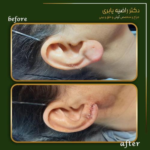 جراحی-گوش-در-تهران-5