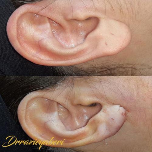 جراحی-گوش-در-تهران-50