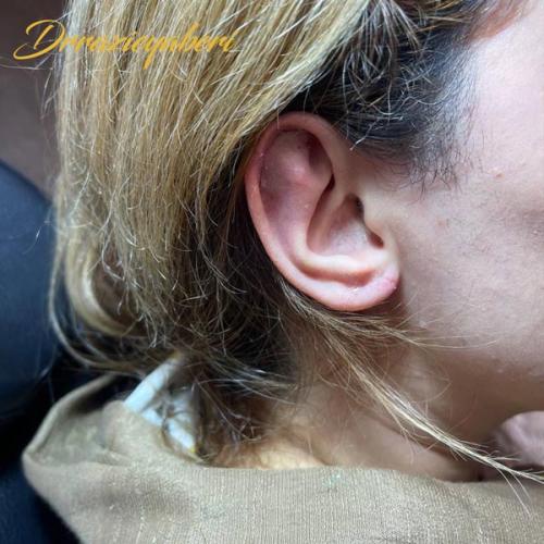 جراحی-گوش-در-تهران-53