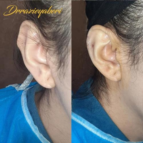جراحی-گوش-در-تهران-54