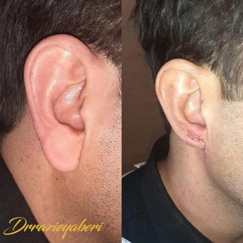 جراحی-گوش-در-تهران-57