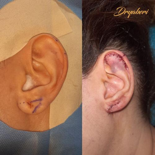 جراحی-گوش-در-تهران-58
