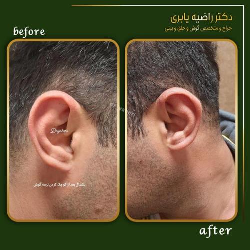جراحی-گوش-در-تهران-6
