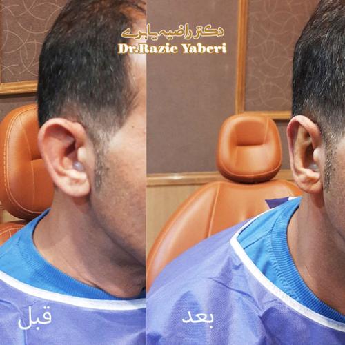 جراحی-گوش-در-تهران-69