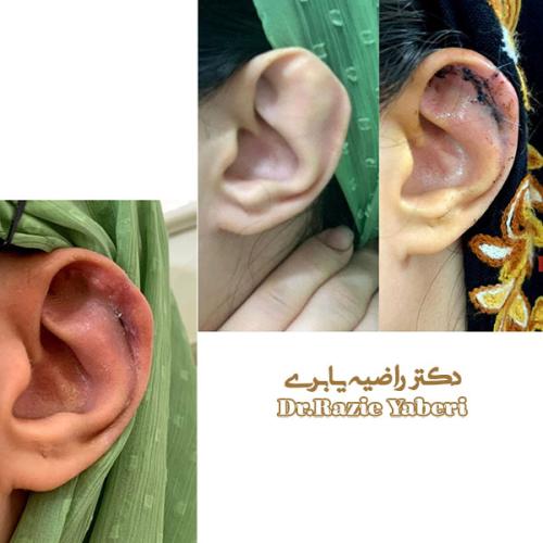 جراحی-گوش-در-تهران-71