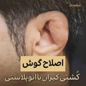 جراحی-گوش-در-تهران-74