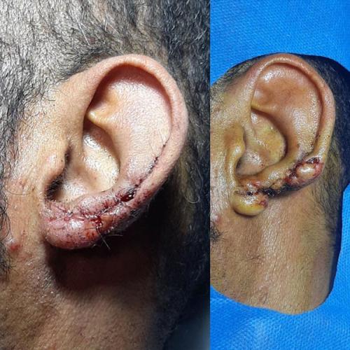 جراحی-گوش-در-تهران1