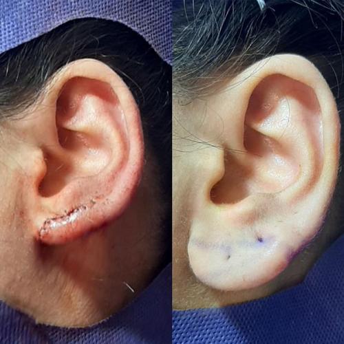 جراحی-گوش-در-تهران10